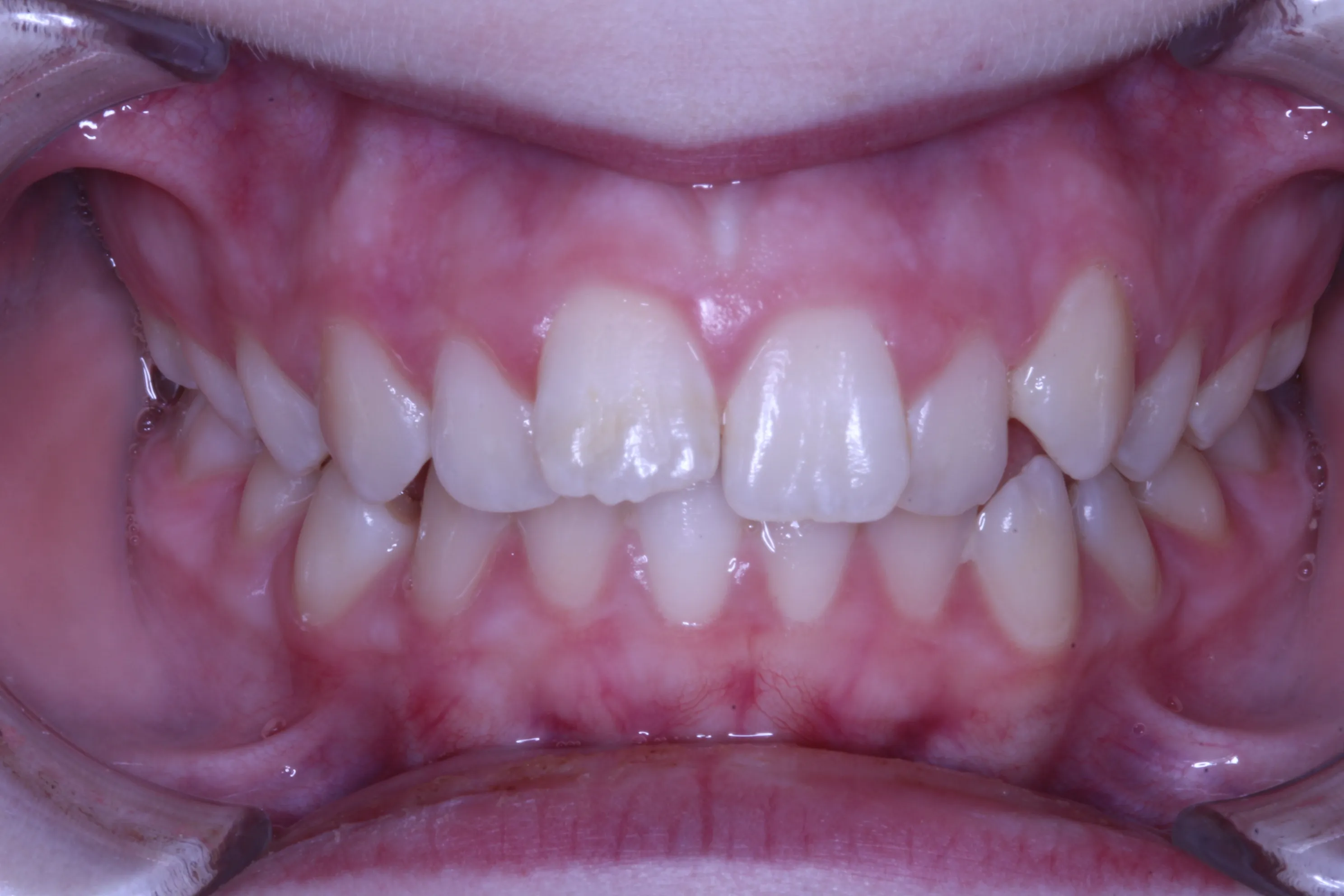 smile-gallery gallery